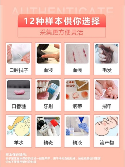 贵州亲子鉴定样本采集指南:口腔拭子、头发、血液哪个最准?