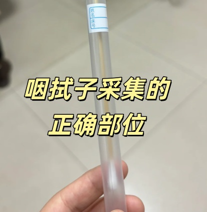 口腔拭子采样有什么讲究？做错这几点DNA可能白采