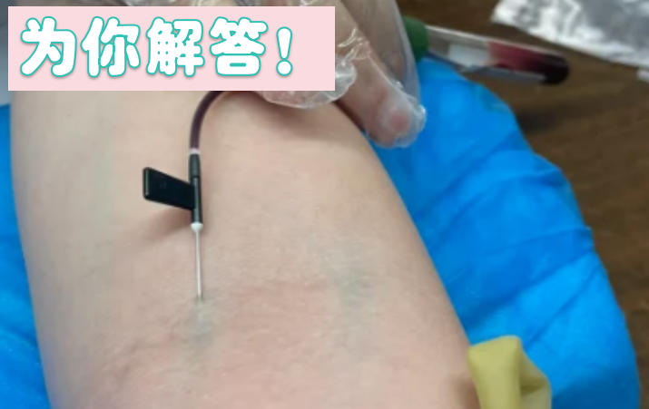 孕妇抽血做亲子鉴定，会伤害胎儿吗