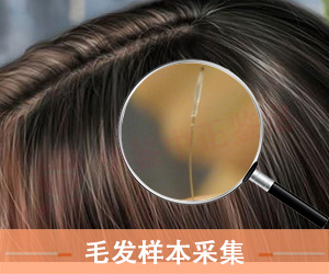 毛发做亲子鉴定需要拔几根?脱落头发能用吗