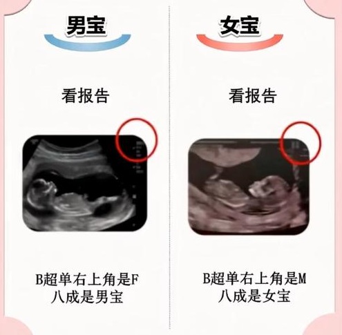 亲子鉴定能鉴定出兄弟姐妹吗？同父异母怎么测