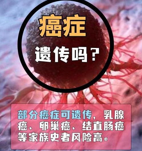 基因检测能查出癌症风险吗?肿瘤基因检测科普