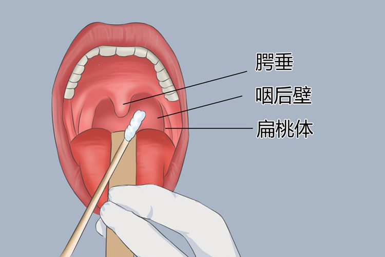 唾液能做亲子鉴定吗？和口腔拭子有什么区别